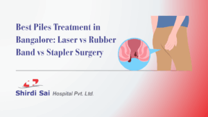 Best Piles Treatment in Bangalore: Laser vs Rubber Band vs Stapler Surgery