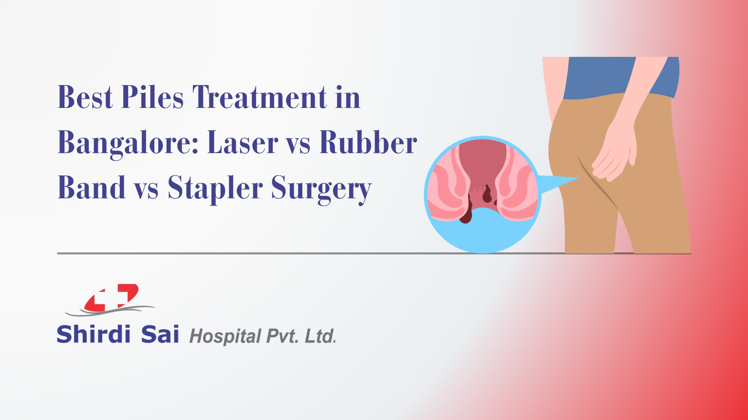 Best Piles Treatment in Bangalore: Laser vs Rubber Band vs Stapler Surgery